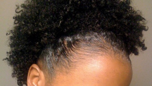 Best Styles For Thinning Natural Hair