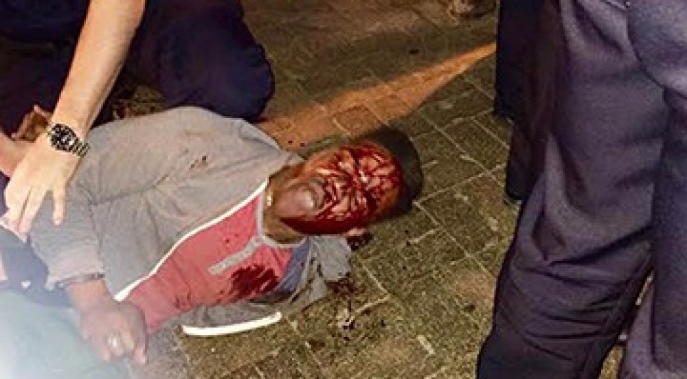 Martese Johnson Case: Agents in Bloody Arrest of UVA Student Cleared of Wrongdoing